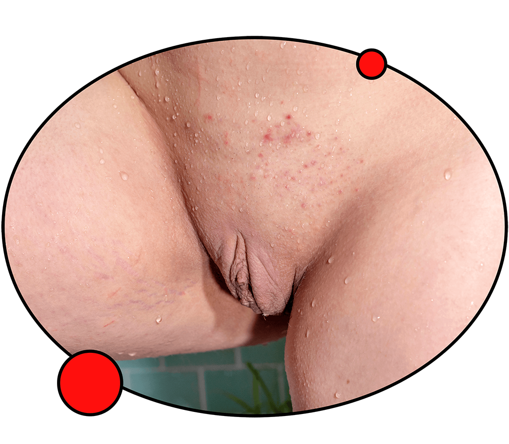 Photos of different vulva skin tones